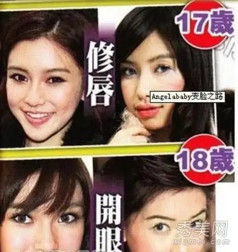 25名整容女演员齐聚郑爽吴佩慈
