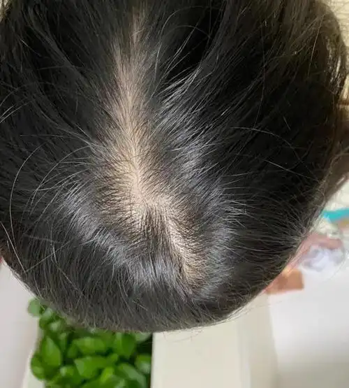 什么洗发水可以防脱发再生发这几款备受国人喜爱
