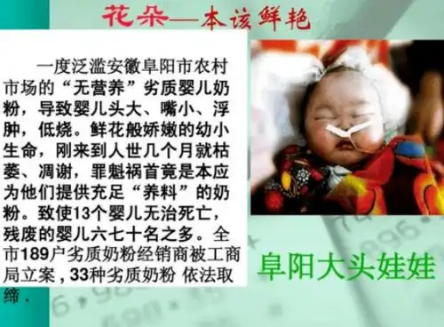 大头娃娃再现抖音引热议5个月女婴全身肥肿,父母涂的宝宝霜竟是毒药
