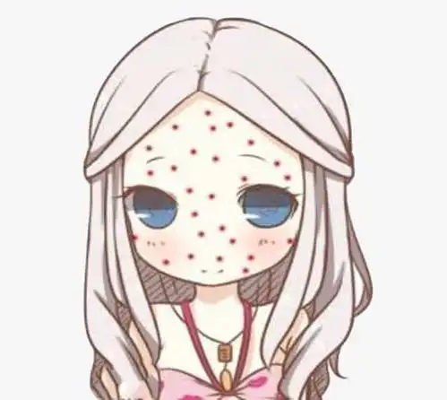 你是属于哪种痘友
