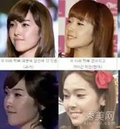 韩国爆红明星整容大集合让人大跌眼镜图
