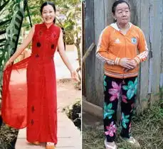 20种不可思议的罕见怪病盘点
