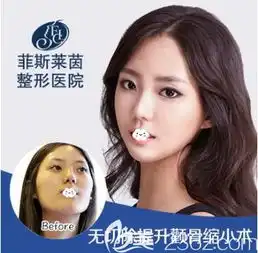 磨骨手术需要多少钱韩国faceline菲斯莱茵李真秀院长讲面部轮廓整形价格与哪些因素有关
