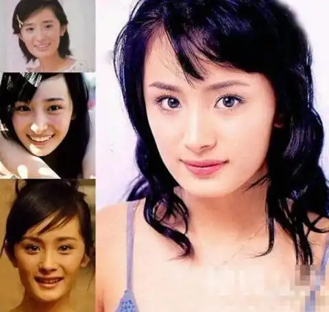 杨幂刘恺威被称假脸夫妇二人整容前后对比照公开
