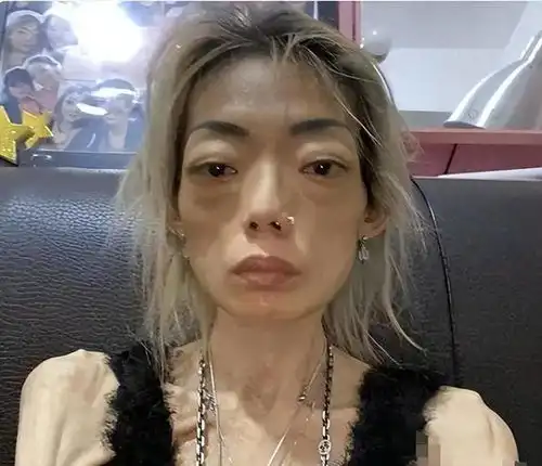 滤镜下是美女,现实中是女鬼这些瘦到病态的明星,真恐怖
