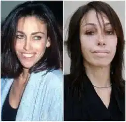 整容的人老了以后会怎样10张对比照让人不忍直视
