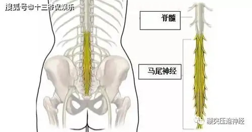 马尾神经综合征饮食应该注意什么
