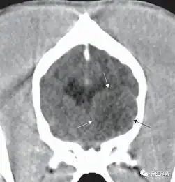 犬脑膜瘤的综述
