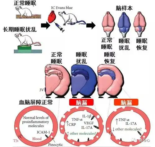 肠漏,你必须知道的热知识9慢性疲劳头疼与睡眠障碍
