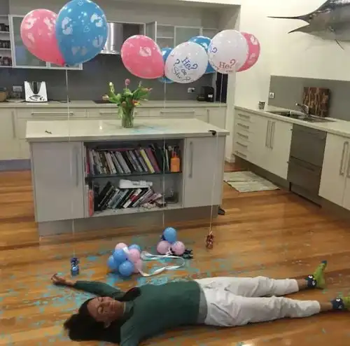 25岁的模特烧伤毁容残肢丨一个经历不幸的幸运者
