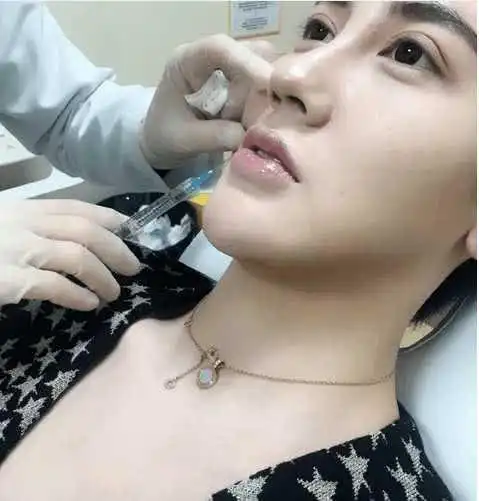 网红刘梓晨拉着母亲去整容,手术之后犹如母女俩
