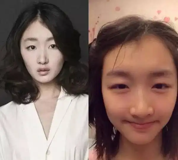 90后女明星素颜谁最丑徐娇黑眼圈黄灿灿眼袋大遮眼袋有妙招

