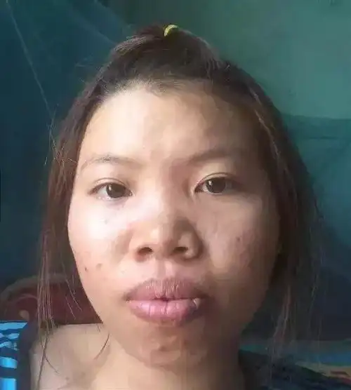 女子太丑没人娶,花近十万整容嫁人你们这些男人啊
