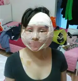 女子16岁开始整容,花巨款整形200次,整后样子让人看了心惊
