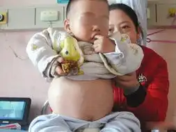 1岁娃得怪病肚子肿成球养父尽一切办法救儿
