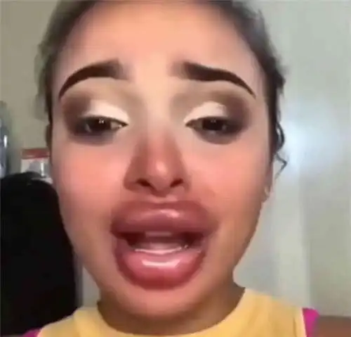 女生脸上有这4个缺陷,化妆美颜也没用,颜值只会越来越低
