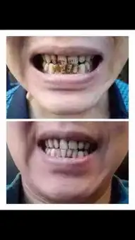 美丽人生从齿开始
