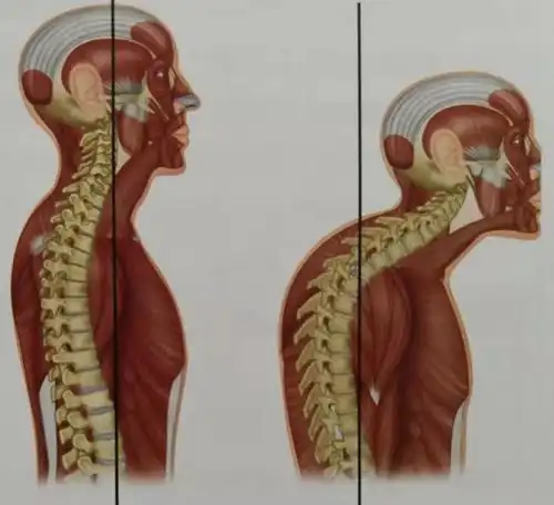 每天十分钟,颈肩背都舒坦
