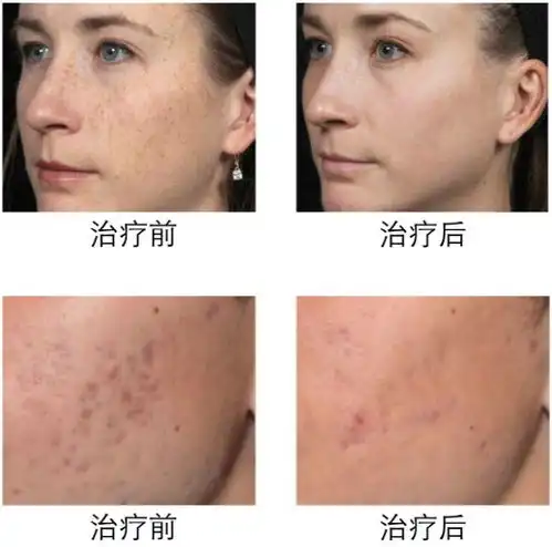 大温偶遇中国第一美女车模抛开国内名利纷扰她在温哥华活成了公主
