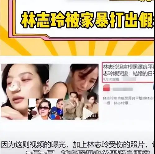 家暴加出轨50岁林志玲姐姐,疑似被小7岁日本老公打得假体飞出
