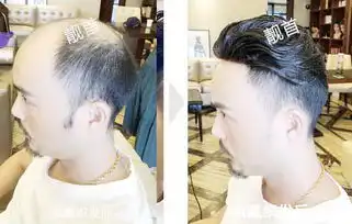 中年男士中老年真发假发背头实拍案例
