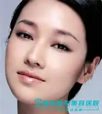 面部除皱术适应症

