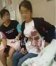 心痛宁海5岁男孩遭大狗疯狂撕咬,浑身上下没一处好的
