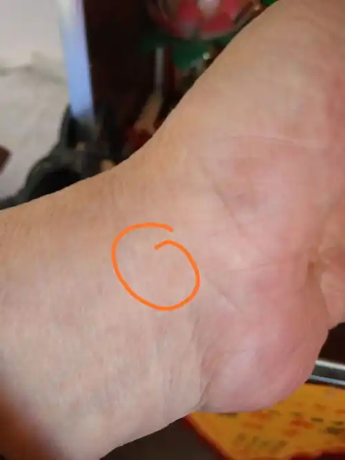 谁能告诉我手上的大动脉在哪里,具体一点

