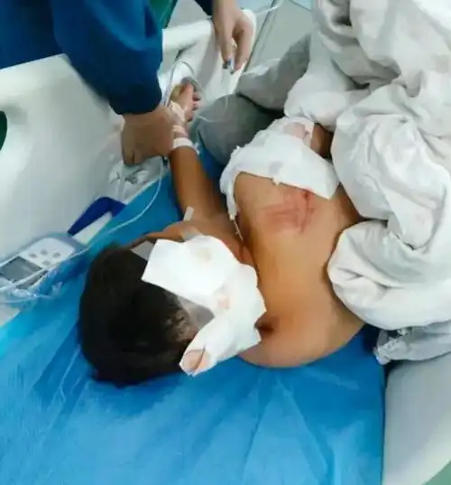 闹大了男孩放学途中被狗袭击后续事发真相曝光,恶犬已被打死
