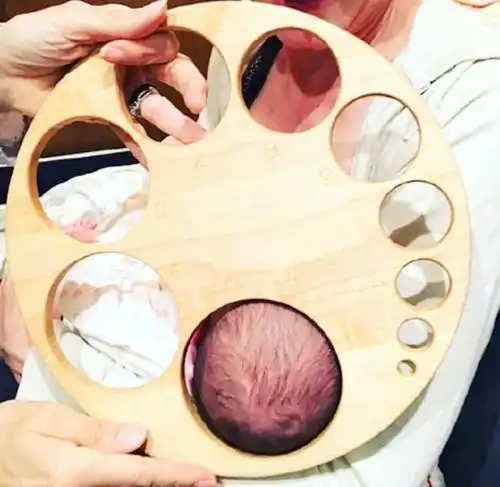 医生口中的开十指,到底是多大看了这张图瞬间明白,收藏了
