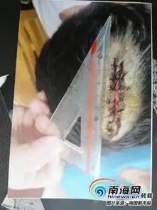 海口航空幼儿园2楼掉下花盆12岁男孩头被砸伤缝8针
