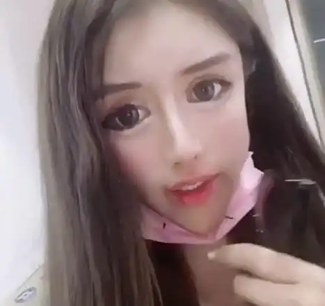 13岁就开始整容的女网红出现后遗症医生称嘴巴缝太多无法修复
