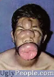 全球四大丑女pk全球四大丑男,自贡在线
