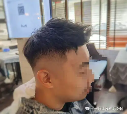 现在那么多中年秃顶,前秃或者发际线后移男人,为什么没有适合的发型

