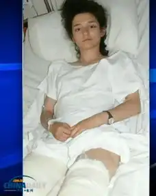 加拿大女孩试图亲吻狮子遭疯狂撕咬奇迹生还
