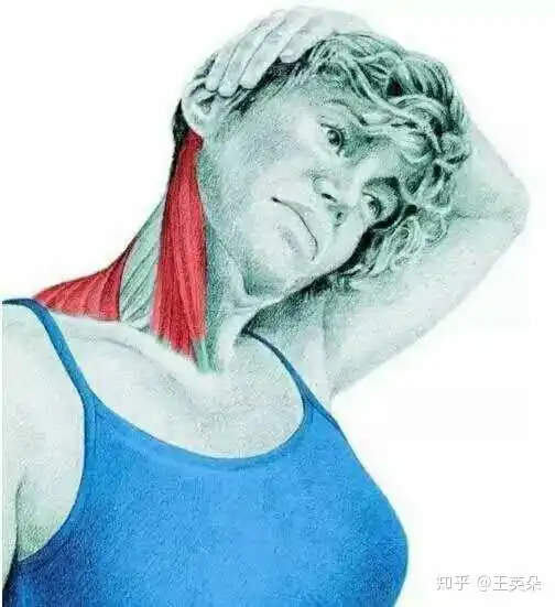 怎么能让颈椎病好起来
