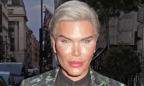 巴西真人版男芭比透露72次整容所有费用,一般人真的不敢想
