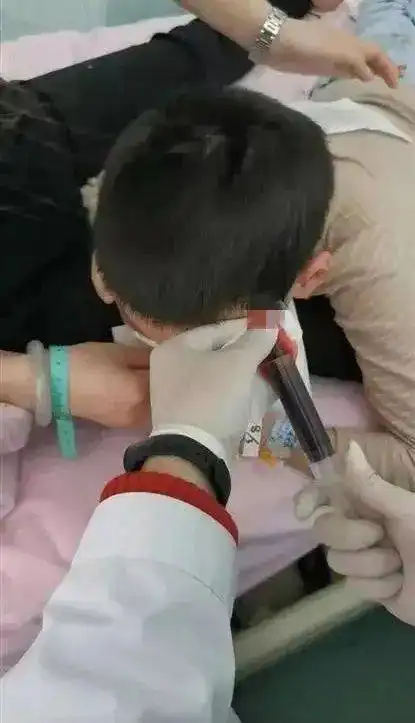 9岁男孩被老师薅头发致头皮头骨分离还想私了
