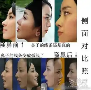 李思思倪萍谢娜2015春晚后备女主持卸妆照
