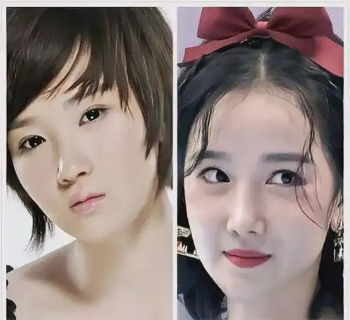 整容上瘾的6位女星,有人换头改命爆红,有人却断送了大好前途
