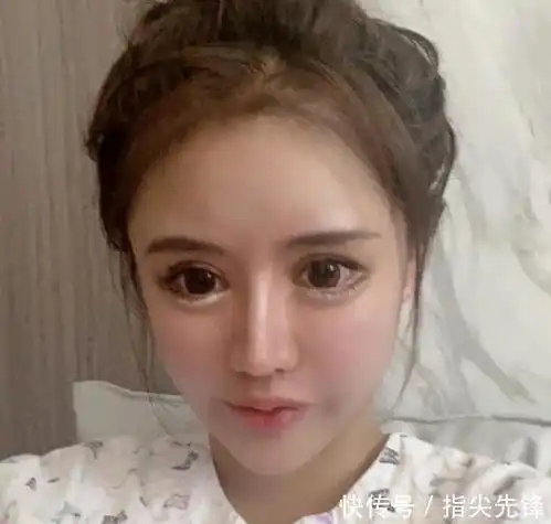 花400万将女儿整成怪物,首批00后热衷整容,家长是推手
