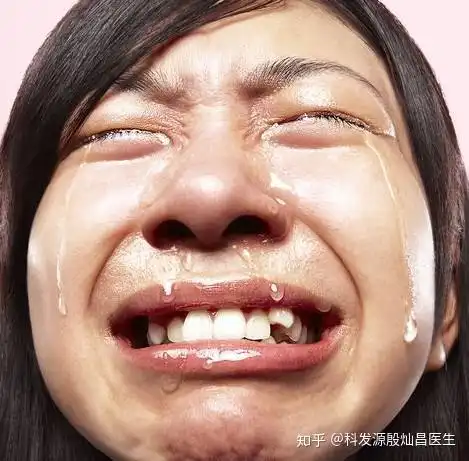 每天一个鸡蛋就能防脱发科学的依据来了
