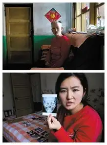 整容失败惨遭毁容的6位女性,看完你还敢整容吗
