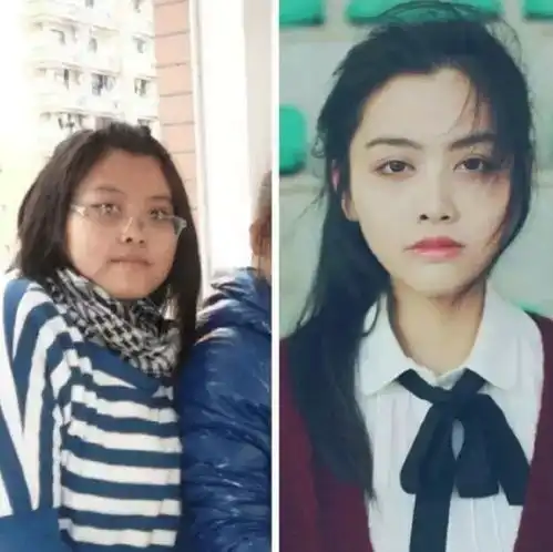 曾经丑得不忍直视的女生,现在美得亲妈不敢认
