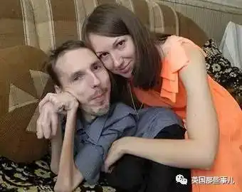 男子全身萎缩到几乎只剩一个头但还是找到了...女朋友
