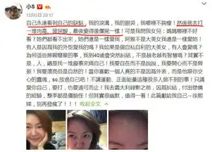 40岁小s亲手剪掉头发后,又自曝脸上打针,晒素颜照少女感十足
