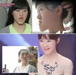 韩整容节目let美人停播5大整形案例看呆了
