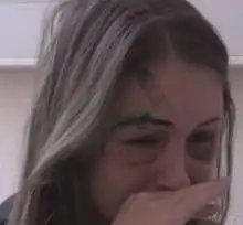 俄美女模特与男友分手被暴打成僵尸脸惨不忍睹
