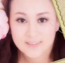 注射瘦脸针前后对比照片大连何医生整形手术实例
