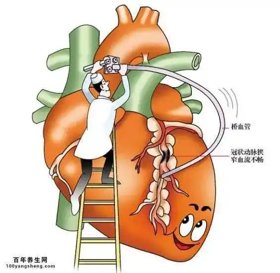 健康生活丨冠心病的这些征兆你有吗
